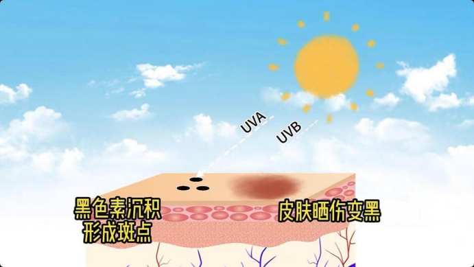 艾詩特蝦青素
