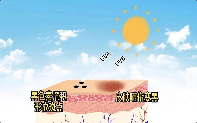 天然蝦青素可以祛斑嗎？